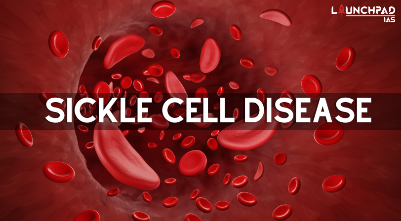 Sickle Cell Disease